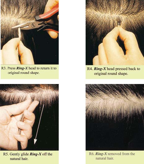 apply ring hair to the head